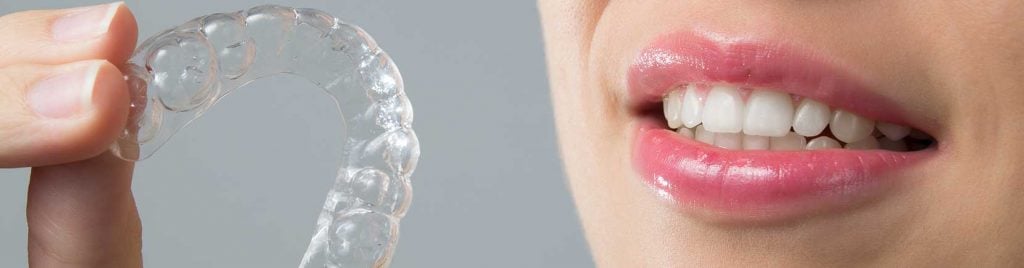 invisalign